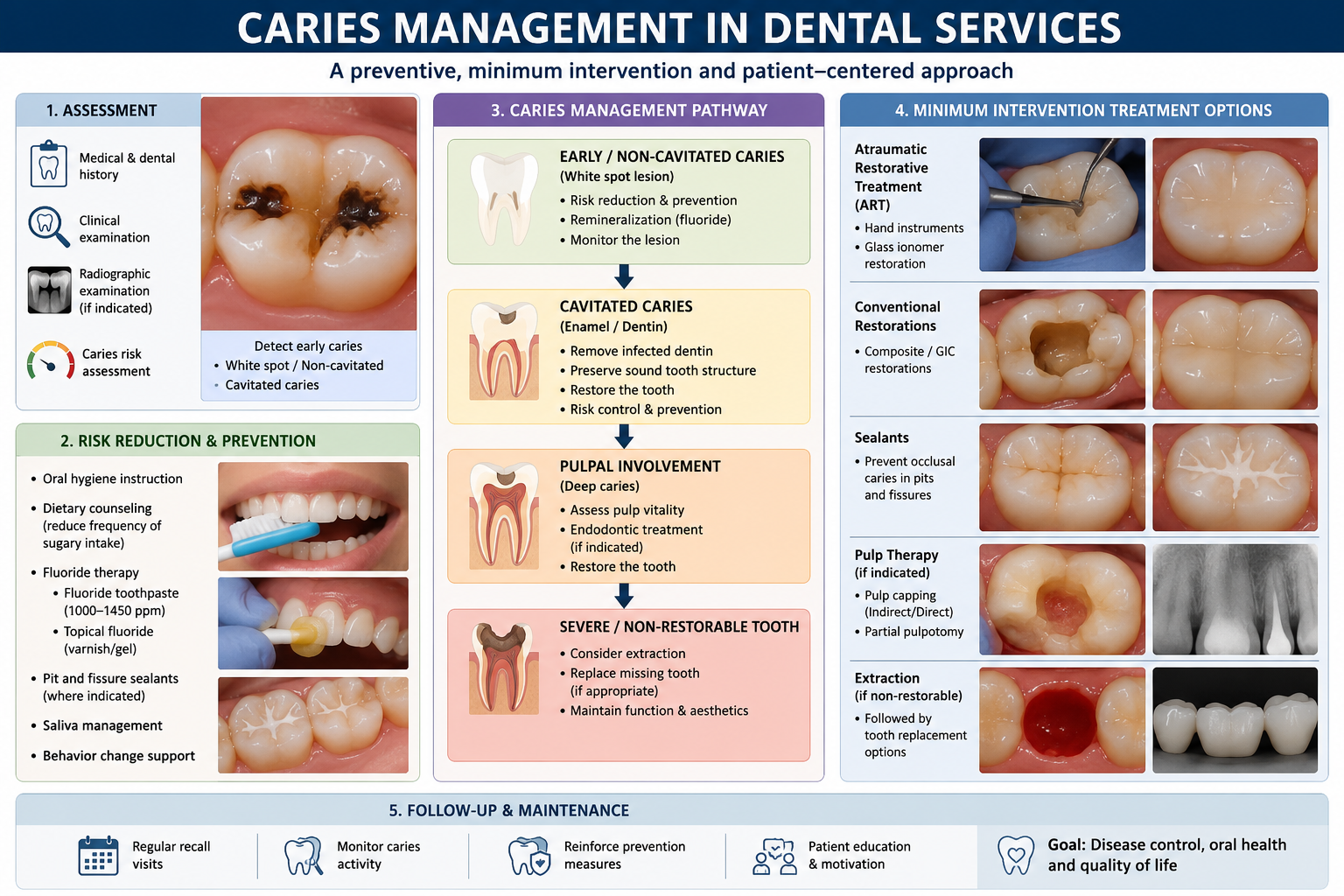 Caries Management
